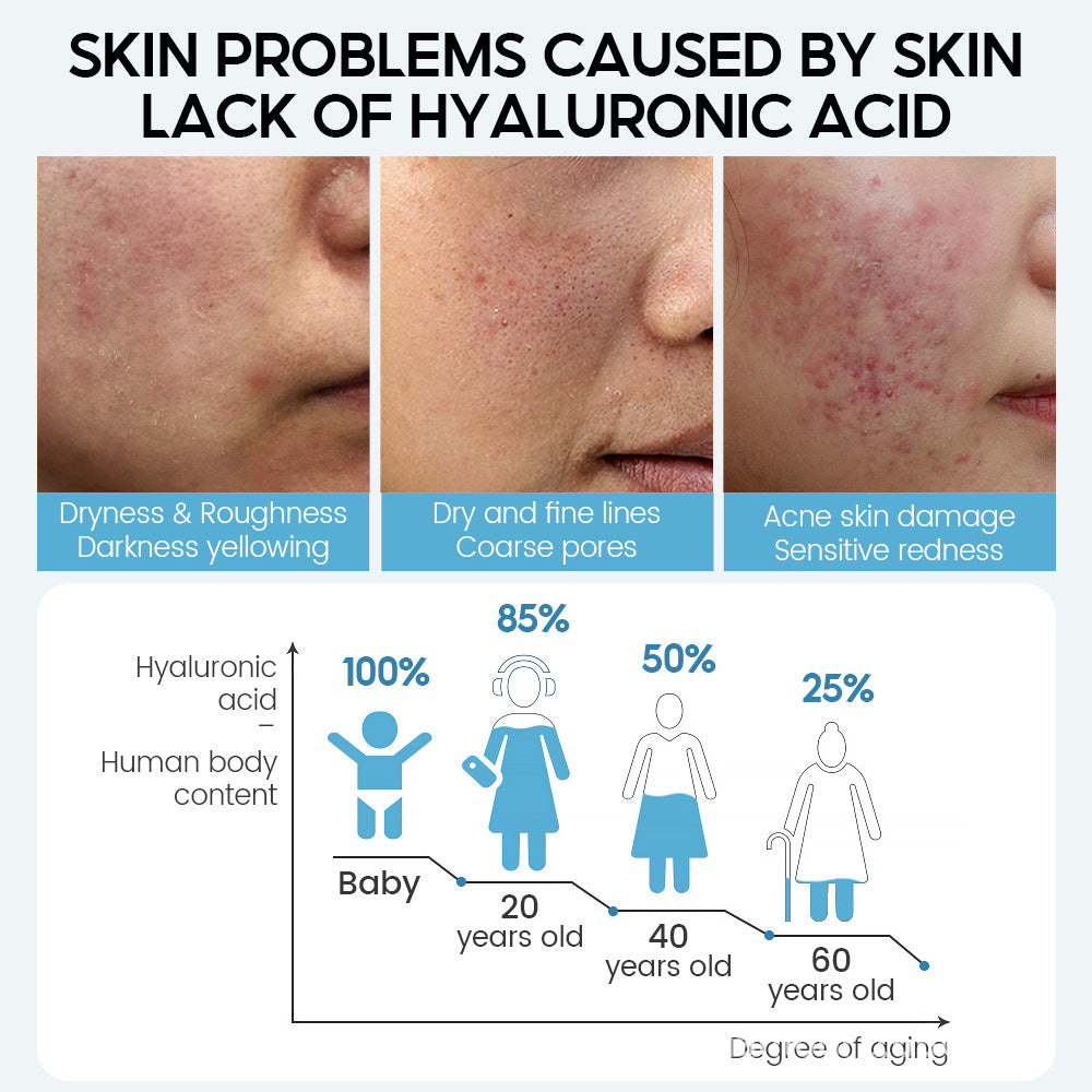 Hyaluronic Acid Serum for Face – Shrinks Pores & Hydrates Dry Skin