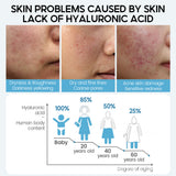 Hyaluronic Acid Serum for Face – Shrinks Pores & Hydrates Dry Skin